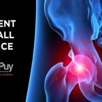 DePuy Hip Replacement Recall