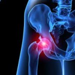 Depuy Hip Replacement Recall Lawyer / The Maher Law Firm